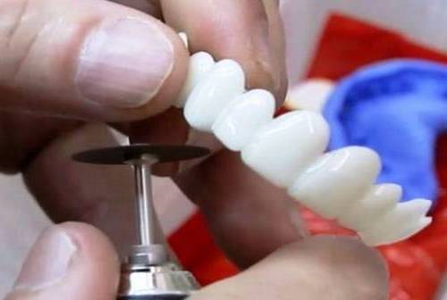طریقه ساخت اسنپ آن اسمایل دندان پزشکی چگونه است