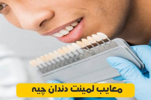 معایب لمینت دندان چیه 