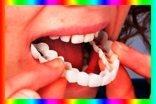 طریقه ساخت اسنپ اسمایل دندانپزشکی 