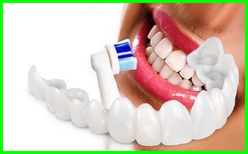 چرا بعد لمینت دندان باید بهداشت بیشتر رعایت شود 